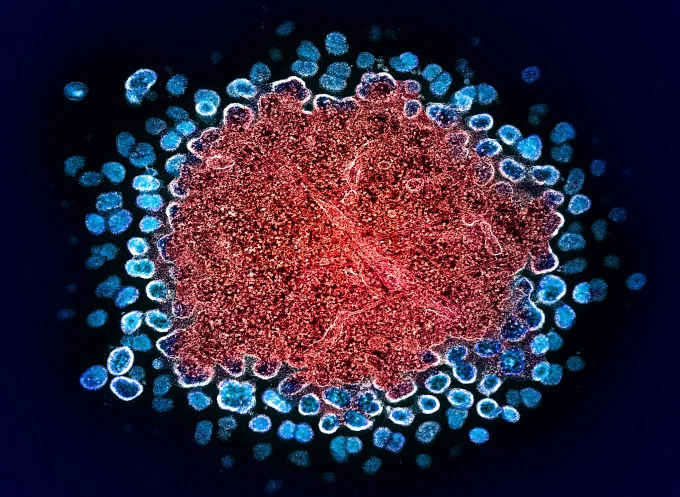 người nhiễm hiv